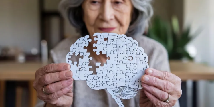 Enfermedad degenerativa que afecta a 40 millones de personas en el mundo comienza a dar sus primeras señales a los 50 años - Foto: Lu17